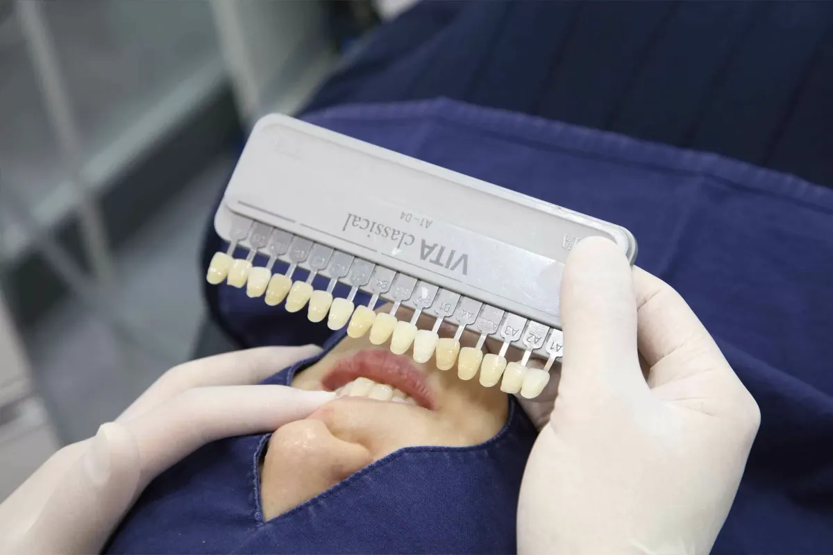 Aesthetic dentistry at Myeongdong Combi Dental Clinic